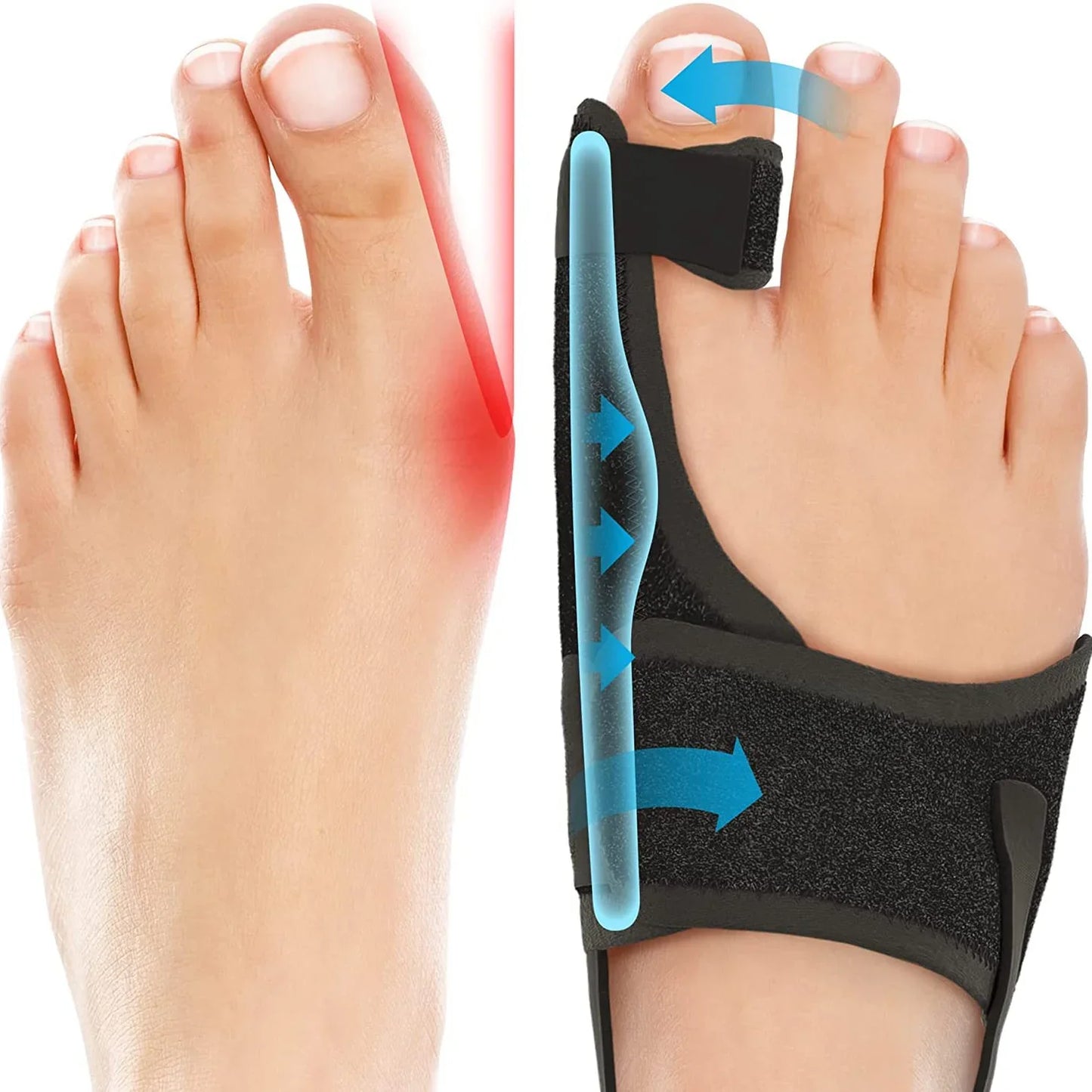 Adjustable Bunion Support & Toe Straightener